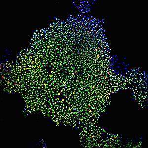 Clulas madre inducidas de piel adulta. (Foto: NIGMS | NIH)